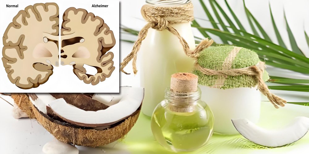 What are the health benefits of coconut oil for you?（images 3）